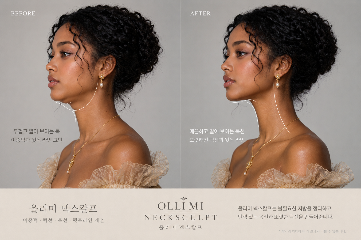 OLLI MI Necksculpt — signature before and after
